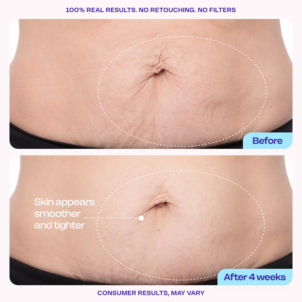 GOPURE - Tighten & Smooth Belly Cream