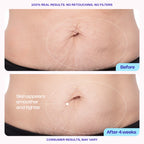 GOPURE - Tighten & Smooth Belly Cream