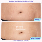 GOPURE - Tighten & Smooth Belly Cream